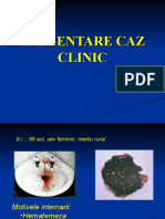 Dokumen.tips Caz Clinic Hds Varice