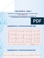 Taller Ekg Grupo B-Tema 1