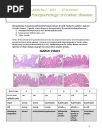 Corazza Villanacci Celiac Classification | PDF | Coeliac Disease ...
