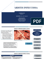 Endocarditis Infecciosa