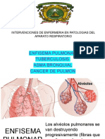 Enfisema Pulmonar Tuberculosis Asma Bronquial Cancer de Pulmon