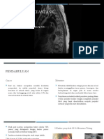 Vertebra Metastase