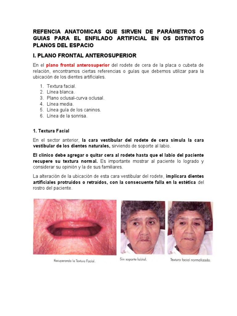 Refencia Anatomicas Que Sirven de Parámetros o Guias para El Enfilado ...