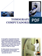 TC: Principais aplicações da tomografia computadorizada