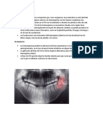 Hemangioma Oral