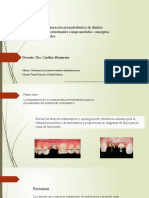 Restauración preendodóntica de dientes estructuralmente comprometidos