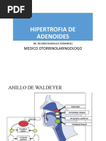 Hipertrofia Adenoamigdalar