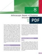 Arthroscopic Repair of Posterior Shoulder Instability