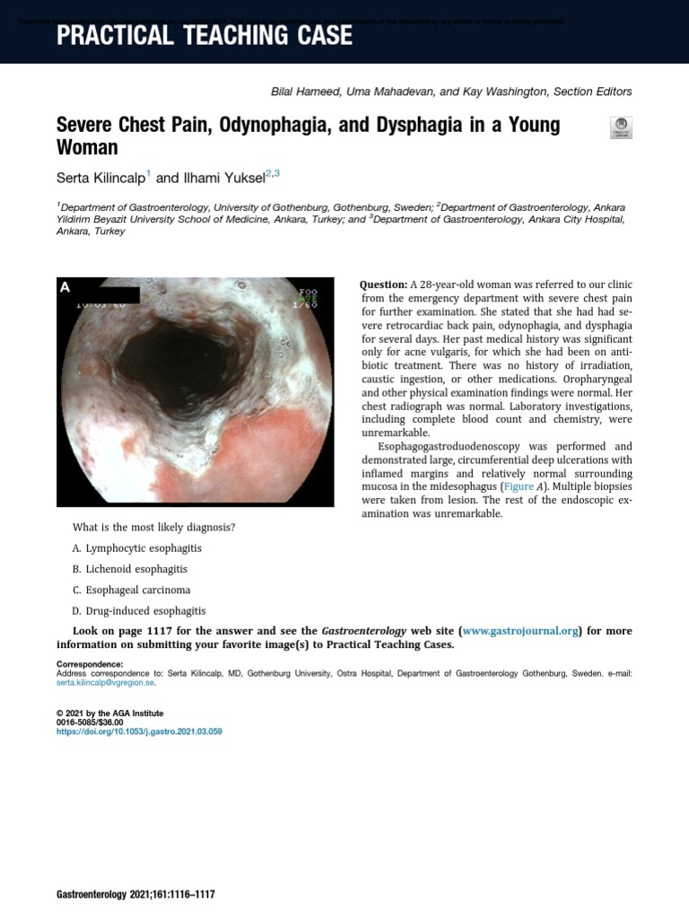 Severe Chest Pain, Odynophagia, and Dysphagia | PDF | Esophagus ...