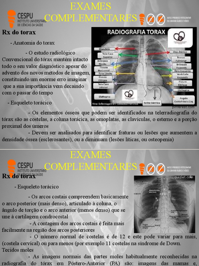RX Do Torax | PDF | Pulmão | Coração