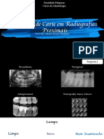 Curso Odontologia Faculdade Pitágoras Detecção Cárie Radiografias