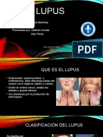 Lupus: Presentado A: Magola Martinez Presentado Por: Katherin Acosta Asly Perez