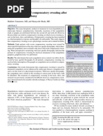 The Management of Compensatory Sweating After Thoracic Sympathectomy