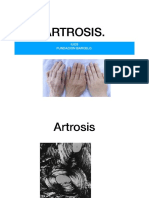Artrosis: causas, síntomas y tratamiento