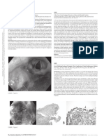 Smoker S Melanosis Isolated Pigmented Lesion In.1603