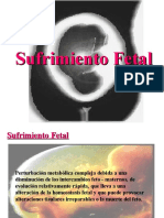 Sufrimiento Fetal