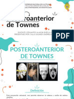 Radiografía posteroanterior de Townes