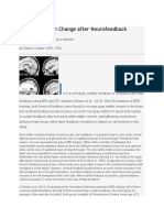 Structural Brain Change After Neurofeedback: Why Sham Feedback Fails As A Placebo