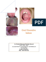 Oral Ulcer, Part 2