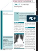 Case 126:: Extramedullary Hematopoiesis