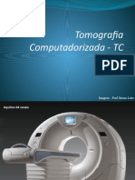 TC-exame-tomografia