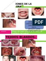 Expo Patologia Alteraciones Mucosa Oral