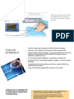 Analisis de La TS y Frcuencia