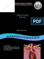 Atelectasias Por RX