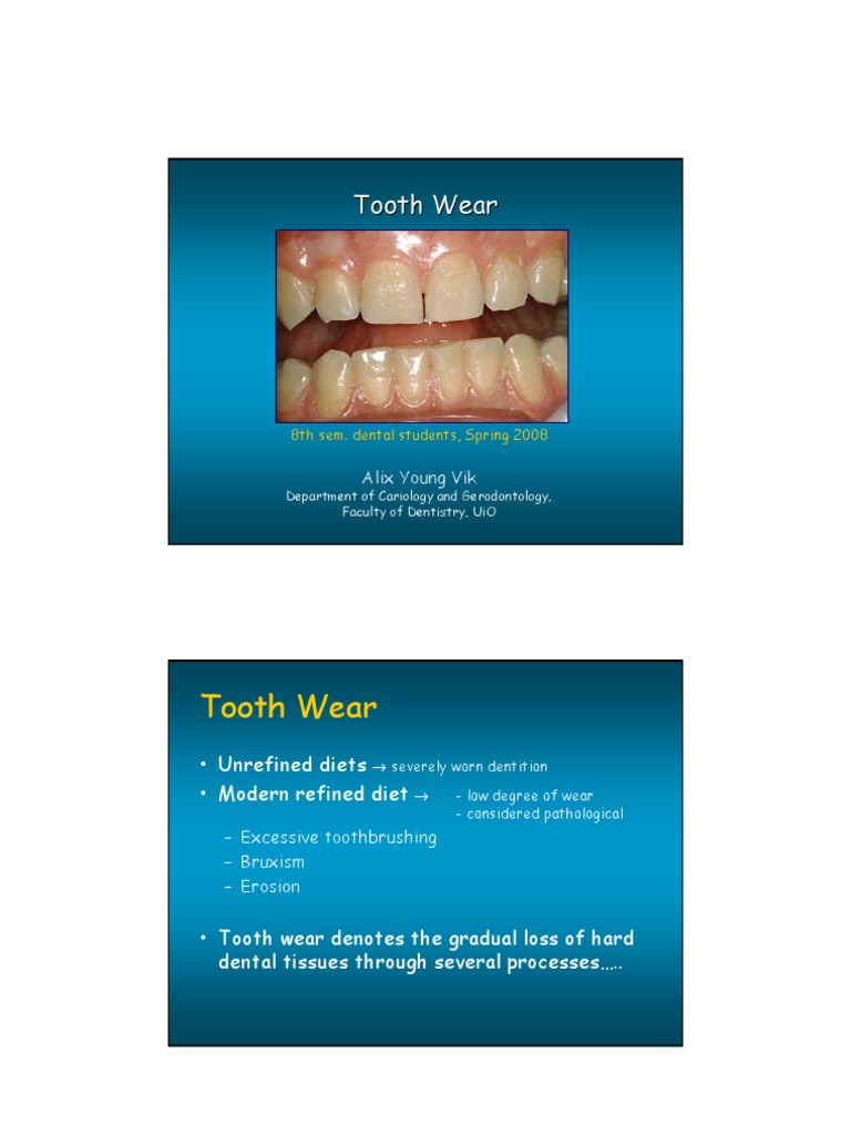 Tooth Wear Tooth Enamel Dentistry