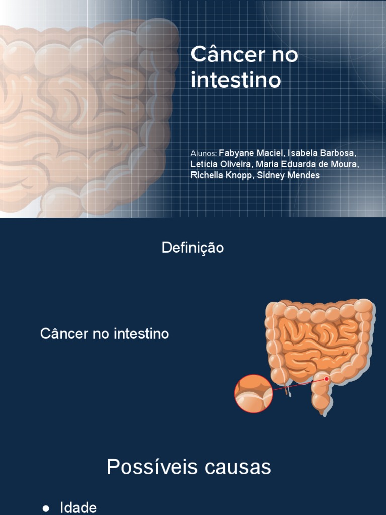 Câncer Intestinal: Causas, Sintomas e Tratamento | PDF