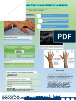 Síndrome de intersección distal, patología infradiagnosticada