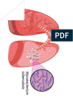 Tuberculosis