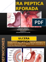 Helicobacter pylori y úlcera péptica perforada