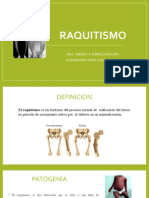 Raquitismo: Definición, etiología, manifestaciones y tratamiento con vitamina D