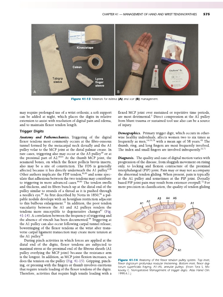 Trigger finger 2 pdf