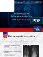 Polineuropatia Diabetica - Imagenologia y Caso Clinico
