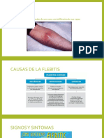 FLEBITIS