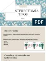 2.3 Histerectomía Tipos: Equipo 4