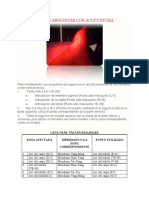 Tratamiento de Esguinces Con Acupuntura