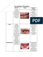 Anomalías Dentales