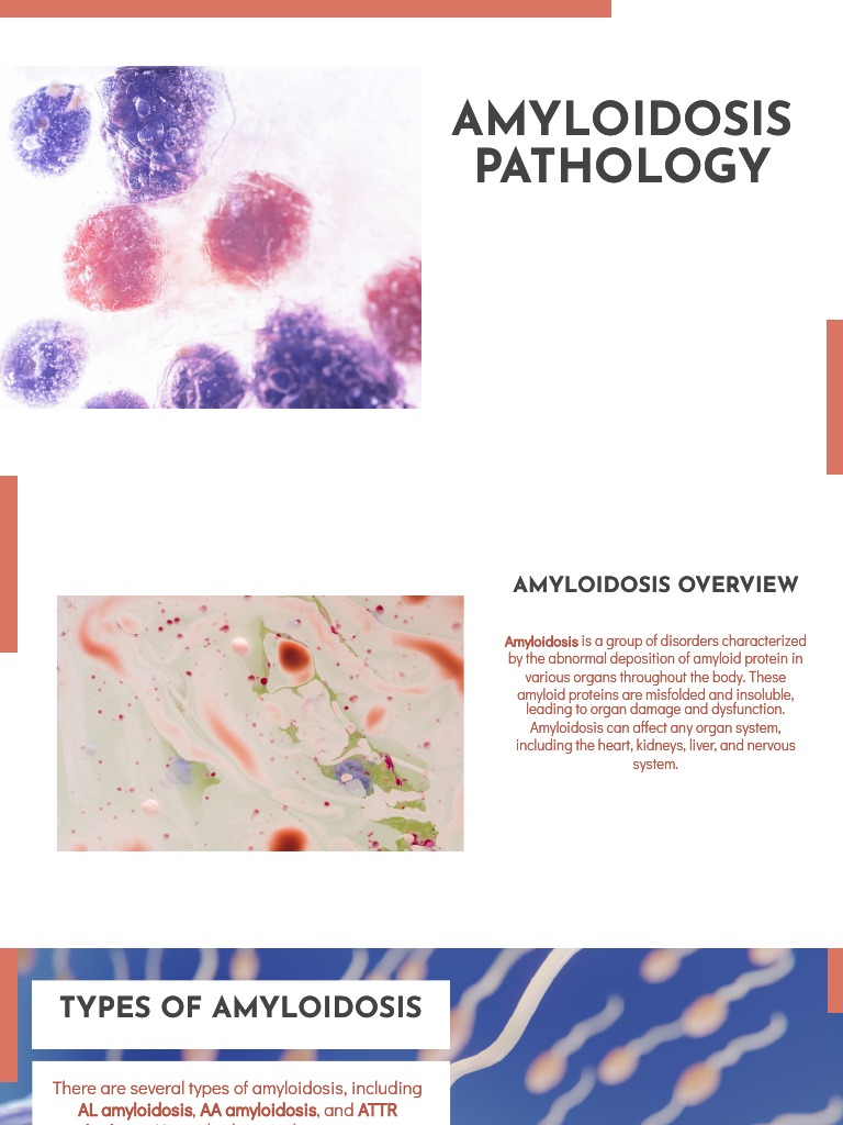 Amyloidosis Pathology Amyloidosis Pathology | PDF