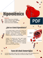 Shock: Hipovolémico