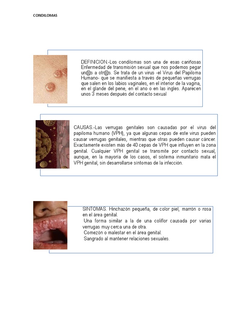 Condilomas: Causas, Síntomas y Tratamiento | PDF | Causas de la muerte ...