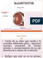 Conjuntivitis Exposicion