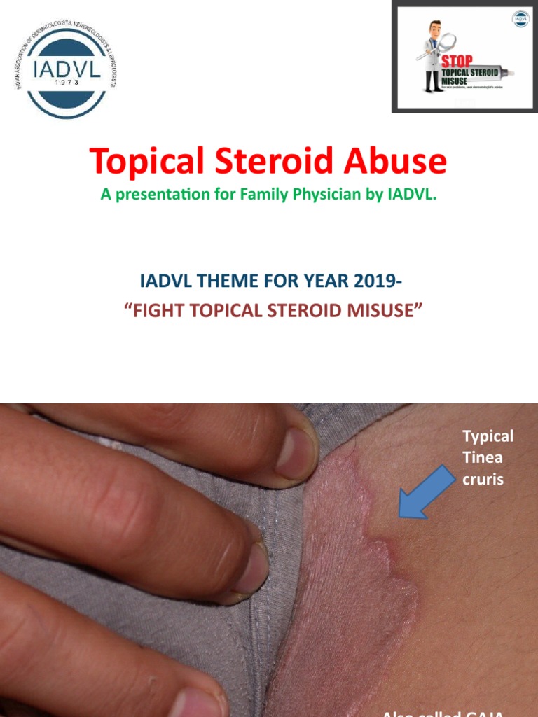 Topical Steroid Misuse in Dermatology | PDF | Dermatitis | Topical ...