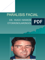 Paralisis Facial: Dr. Hugo Hawkins P. Otorrinolaringologo