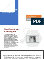Manifestaciones Radiológicas: Irene Simonvil Matrícula: 1-17-0050