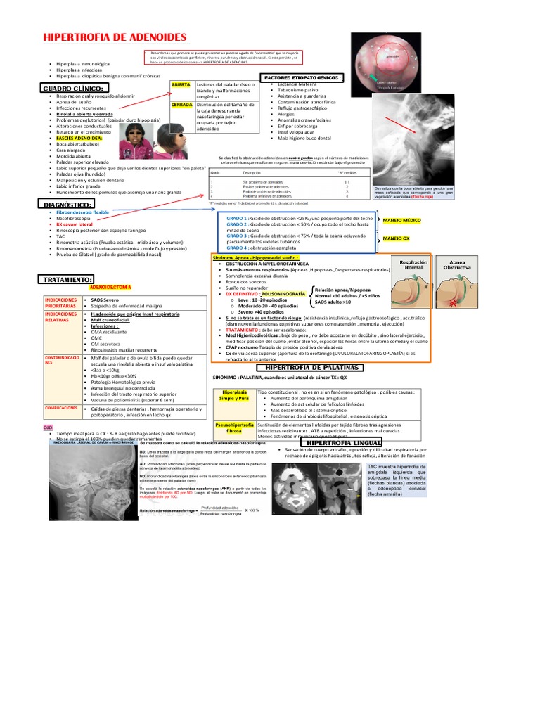 hipertrofia-de-adenoides-pdf-ronquidos-causas-de-la-muerte