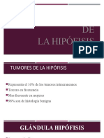 Tumores: DE La Hipófisis