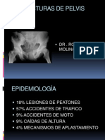 Fractura de Pelvis